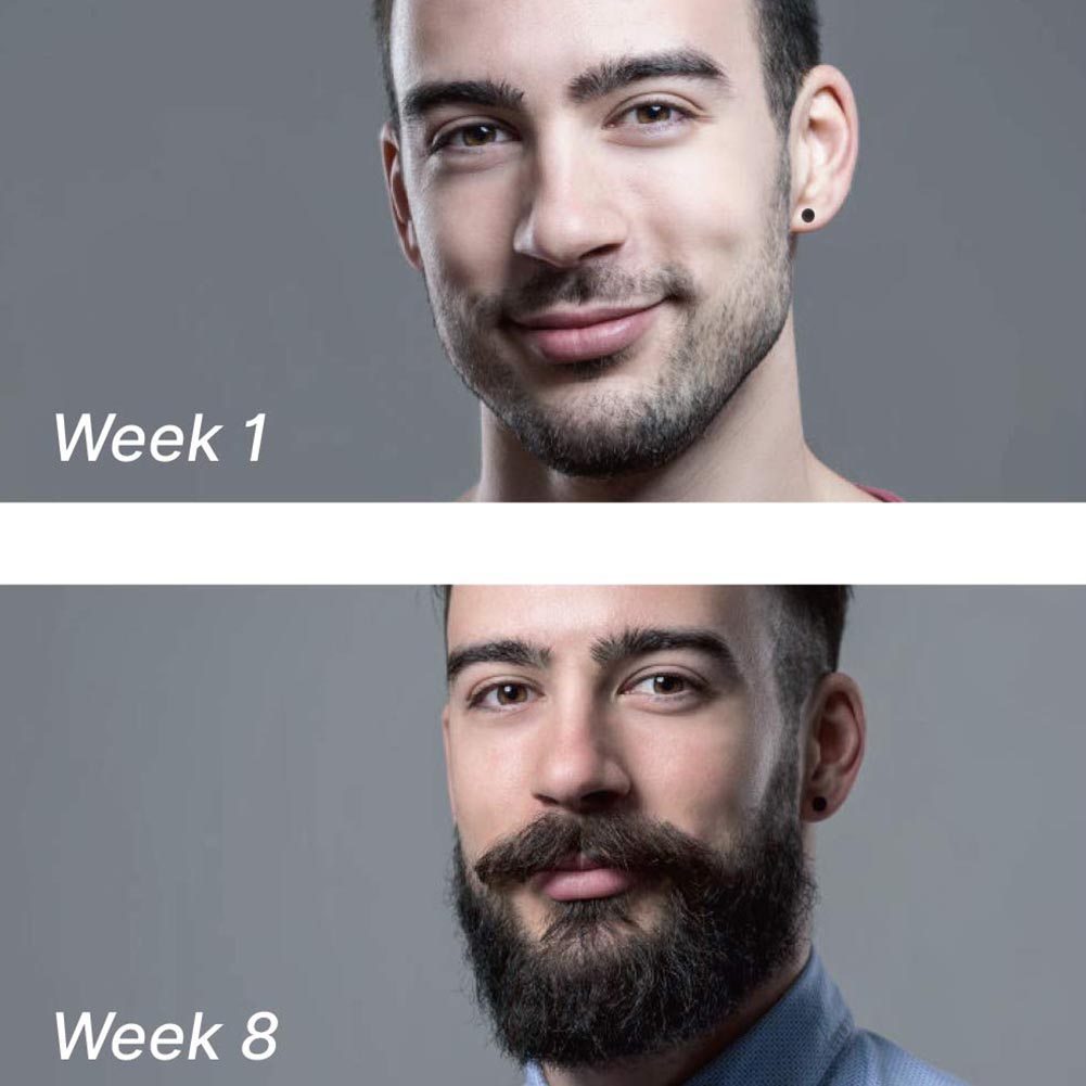Men Beard Growth Serum Oil Micro Needle Roller 0 25mm Beard Hair Growth Kit Ebay